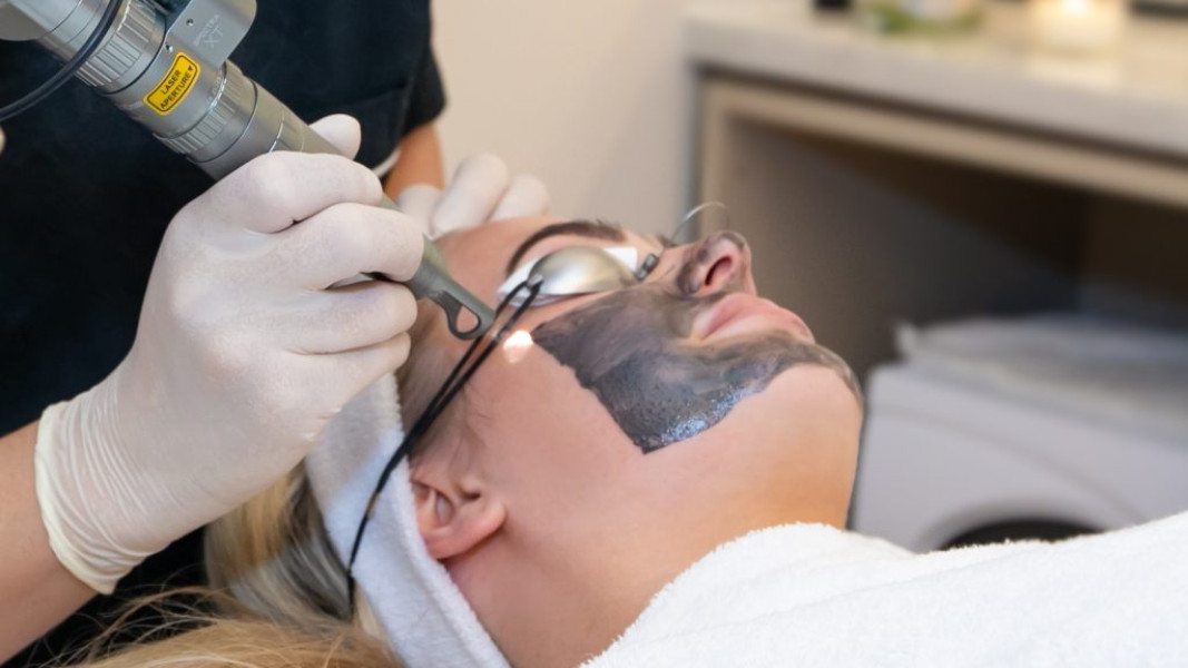 Priebeh epilácie laserom